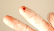 Surgical Gloves Don’t Protect You From Sharps Needle Stick Everything You Need To Know