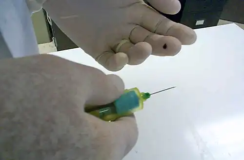 Accidental Needle Stick Virginia What Next