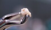 Can I Dispose Of Extracted Teeth In The Medical Waste Box? Everything You Need To Know