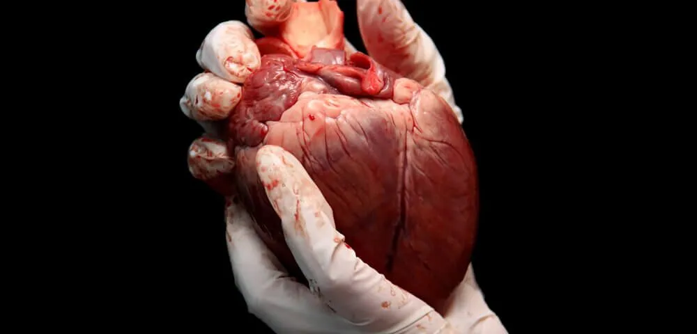 Anatomical Waste Management