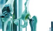 Recycling Metal Implants After Death: Global Guide Everything You Need To Know