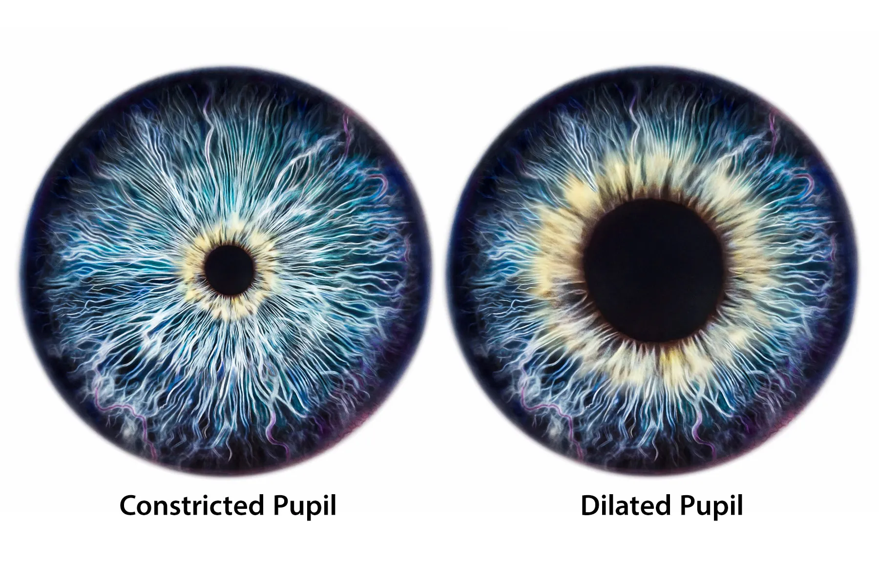 Dilated Eyes During Eye Exam