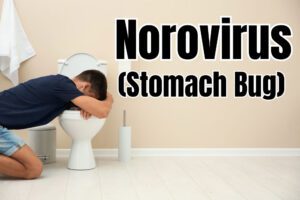 What Is Norovirus