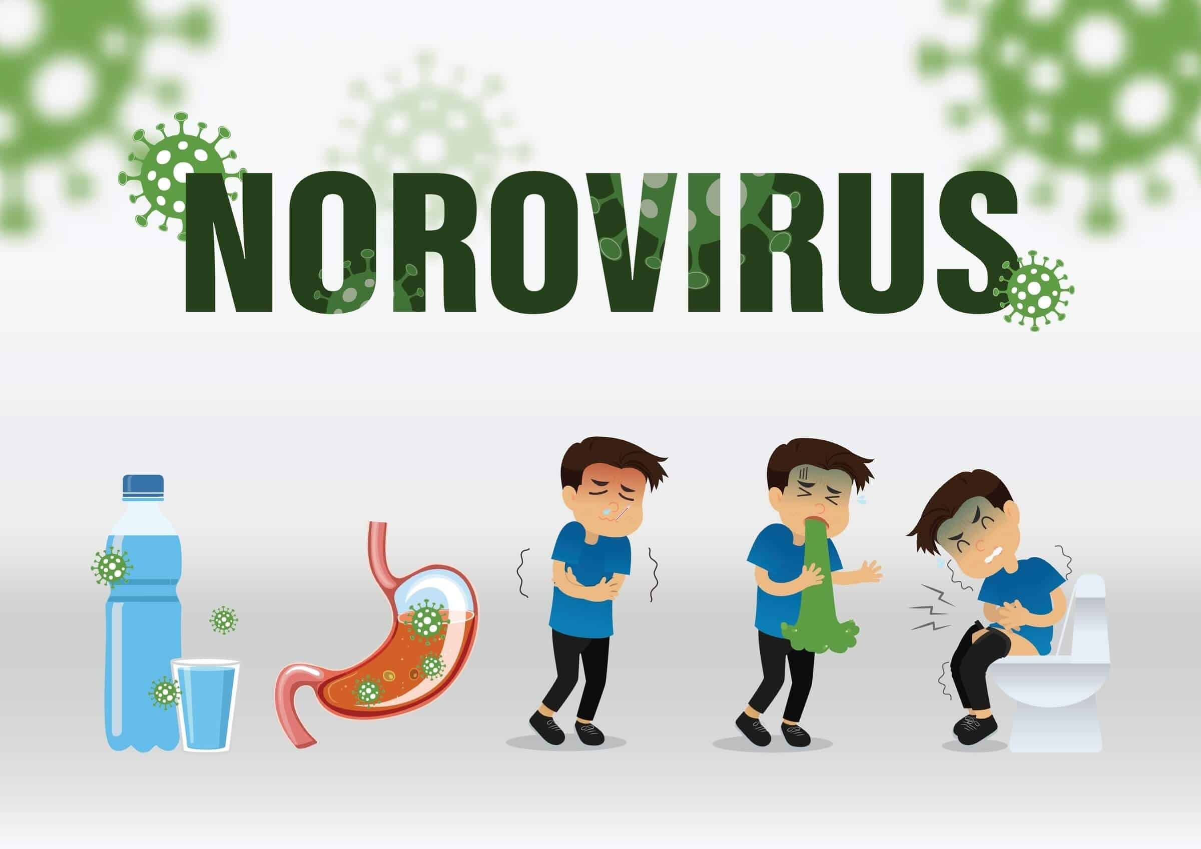 What Is Norovirus Infection