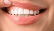 What Kind Of Dentist Does Enameloplasty? Free Guide Everything You Need To Know