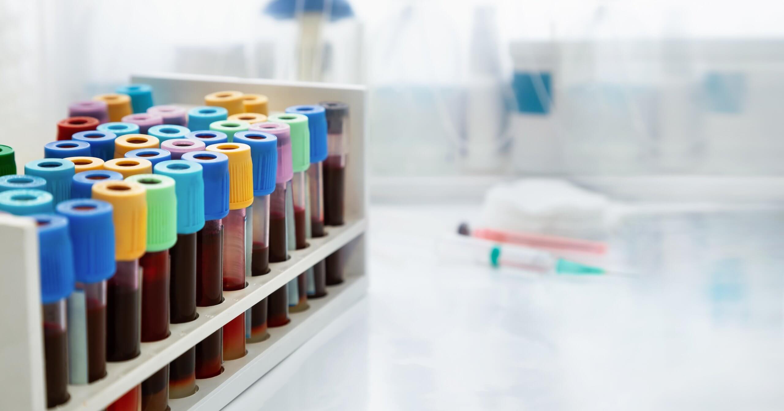 Due to their potential to cause injury these glass vials are classified as sharps waste