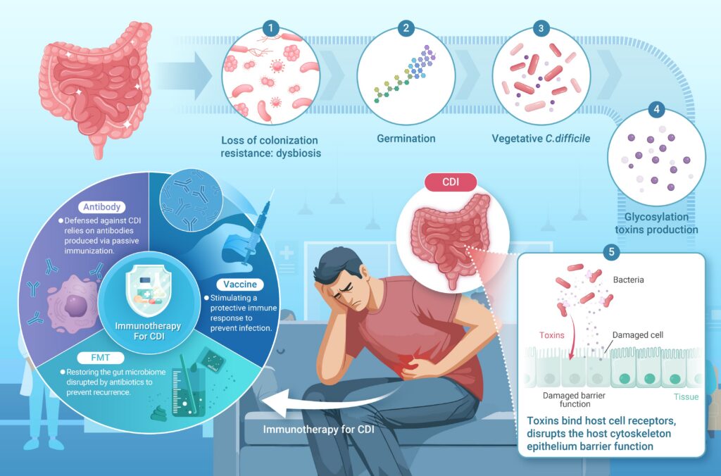 Learn How To Manage C. Difficile (C. diff) Biohazard Waste