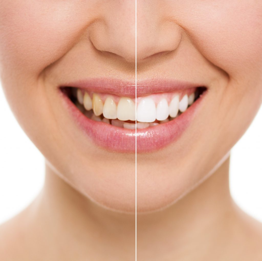 What Is A Cosmetic Dentist DMV