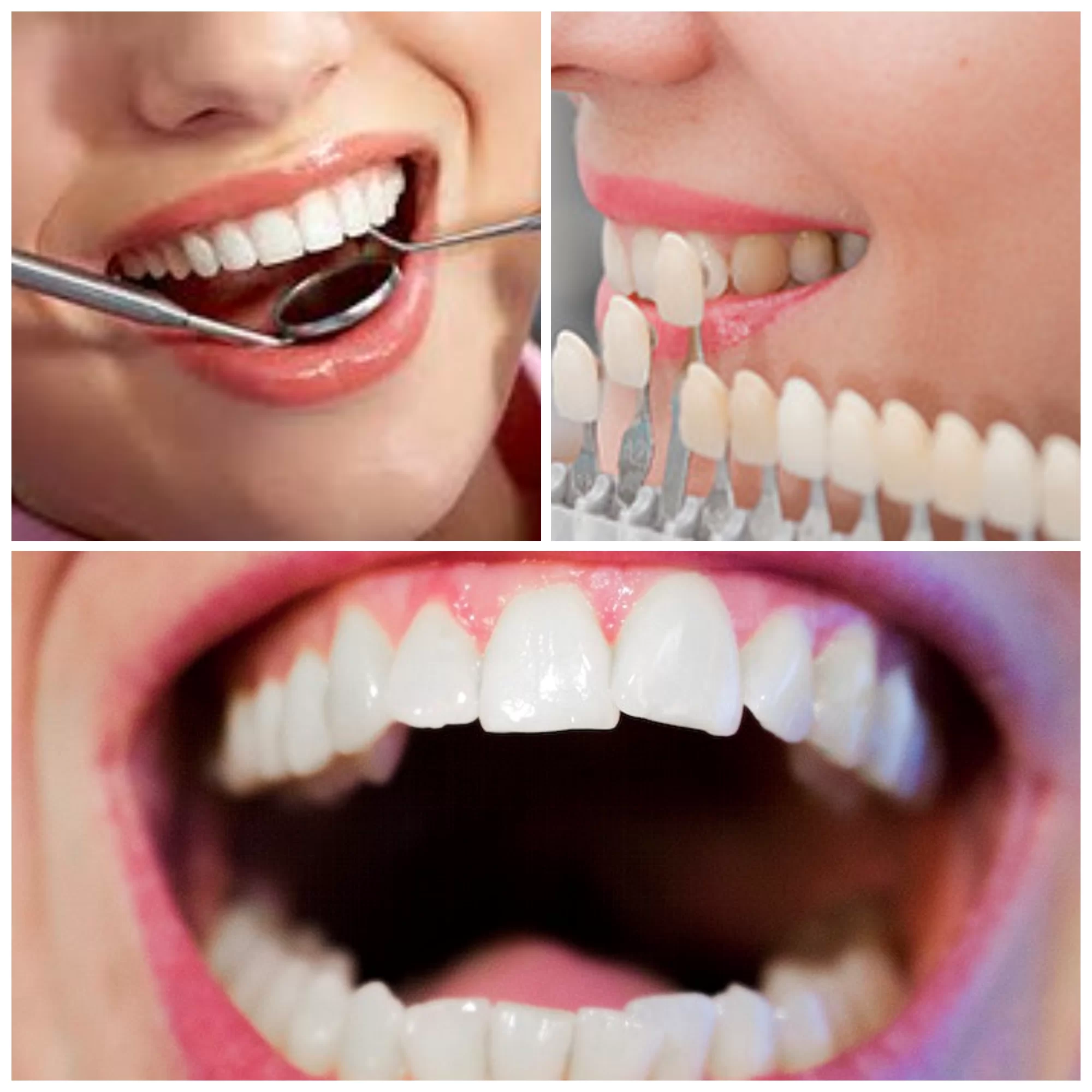 What Is A Cosmetic Dentist: Free Guide Everything You Need To Know